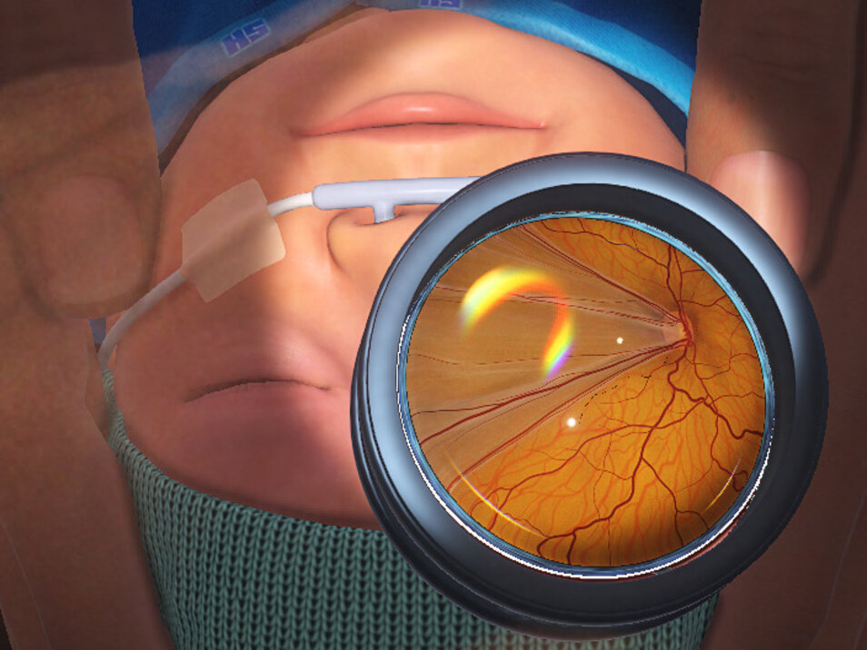 Eyesi Indirect ROP